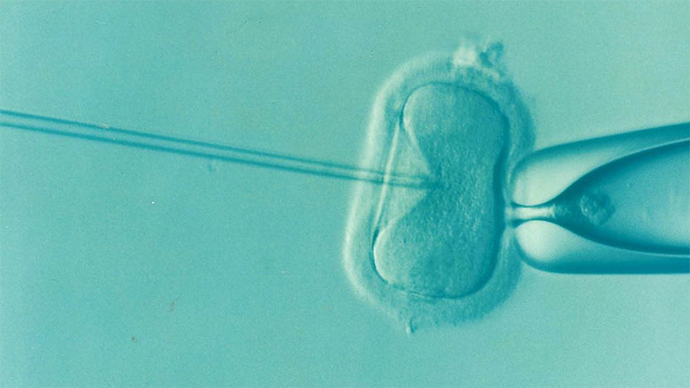 ivf-treatment-cell-780.jpg