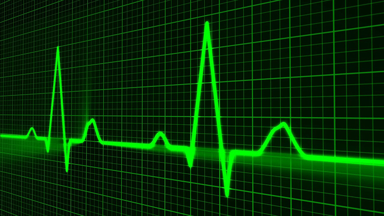 pulse-heart-beat-monitor-780